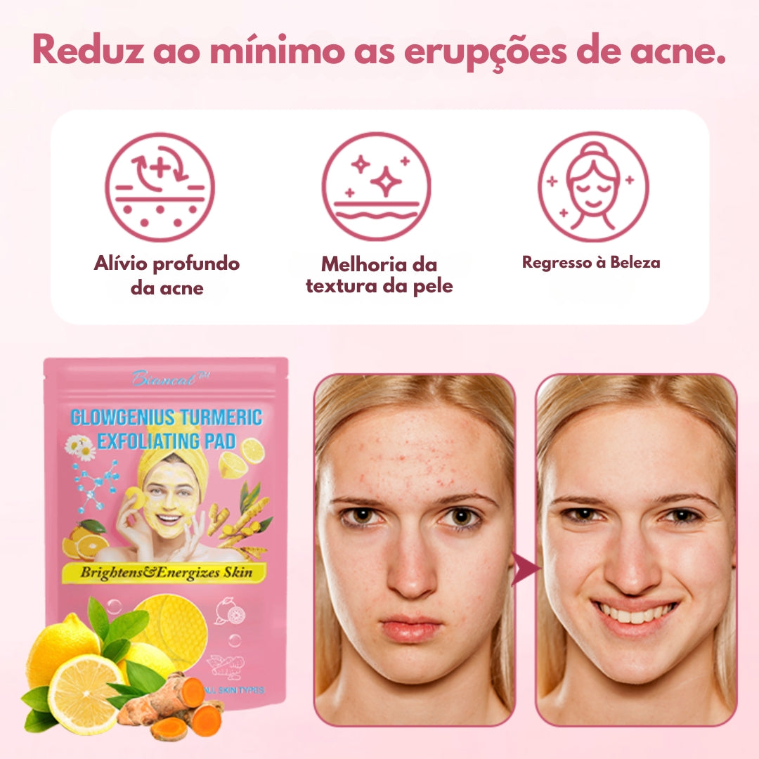 Turmeric Pads - Almofadas de ácido kójico e açafrão - Compre 1 e Leve 2 ( Oferta Black-Friday )